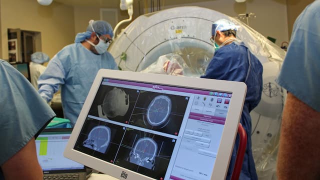 The science behind deep brain stimulation for depression